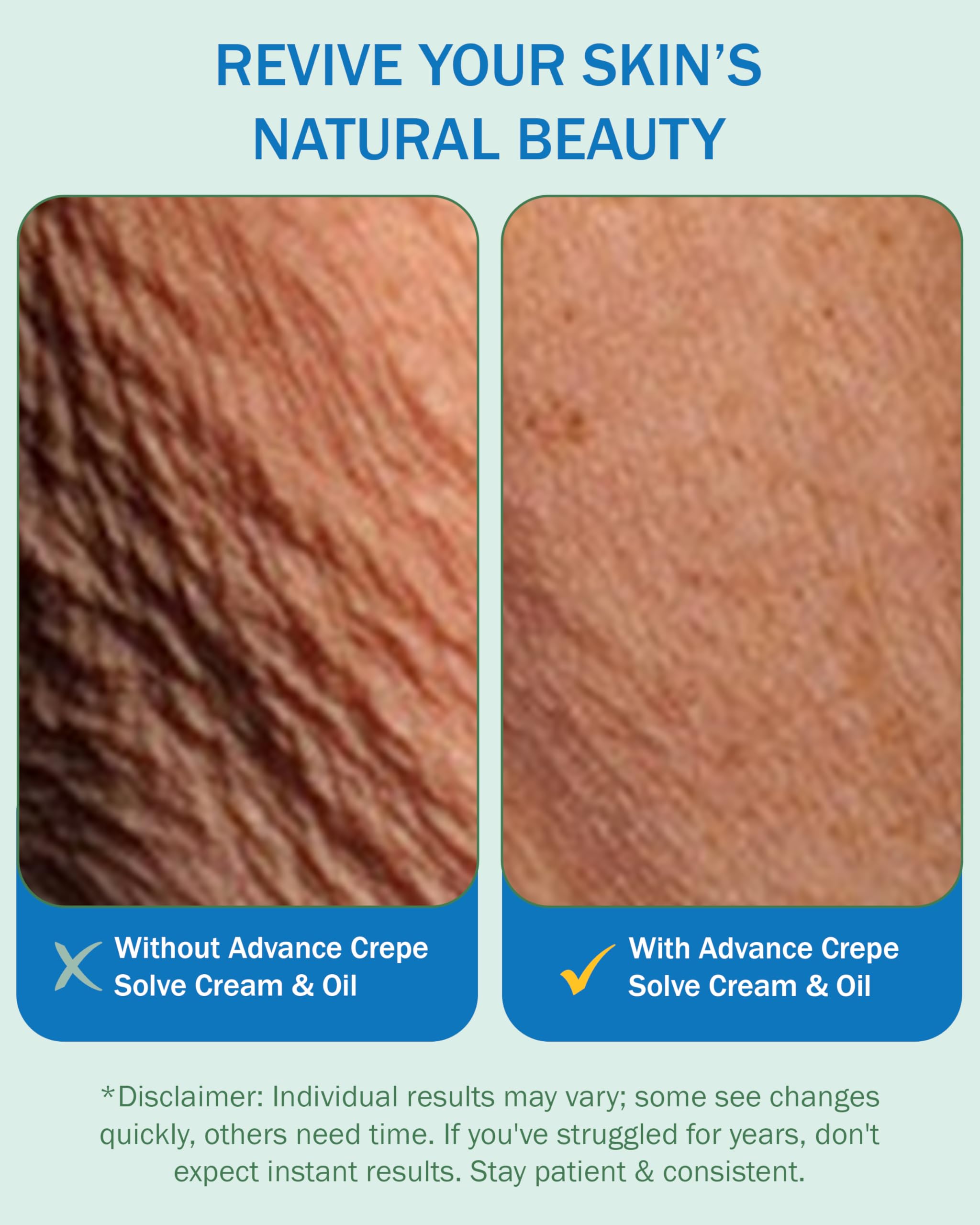 e70 Crepe cream applied on arm to support texture after use