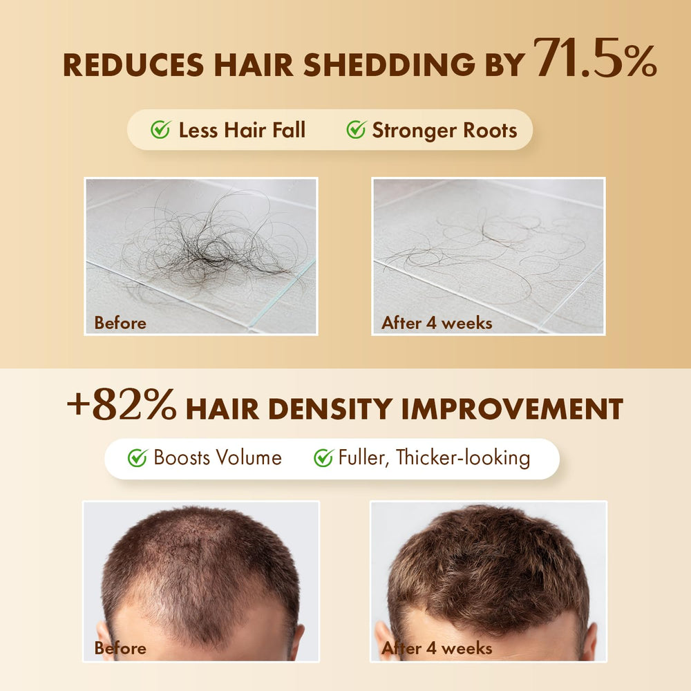EarthShine multi-peptide and caffeine formula bottle highlighting density-friendly ingredients.