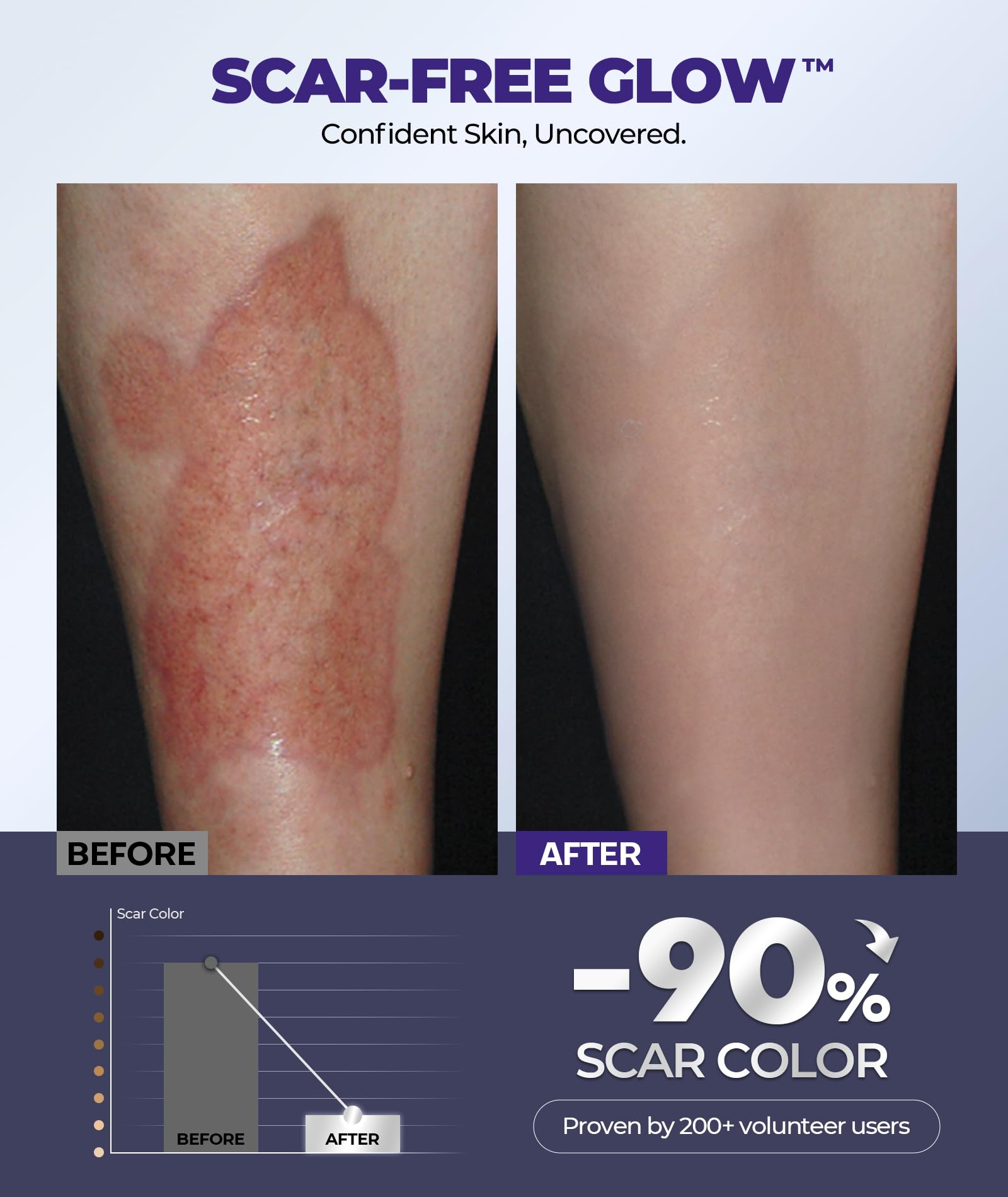 EASEWAVE scar cream helps dry skin with extended 72-hour comfort.