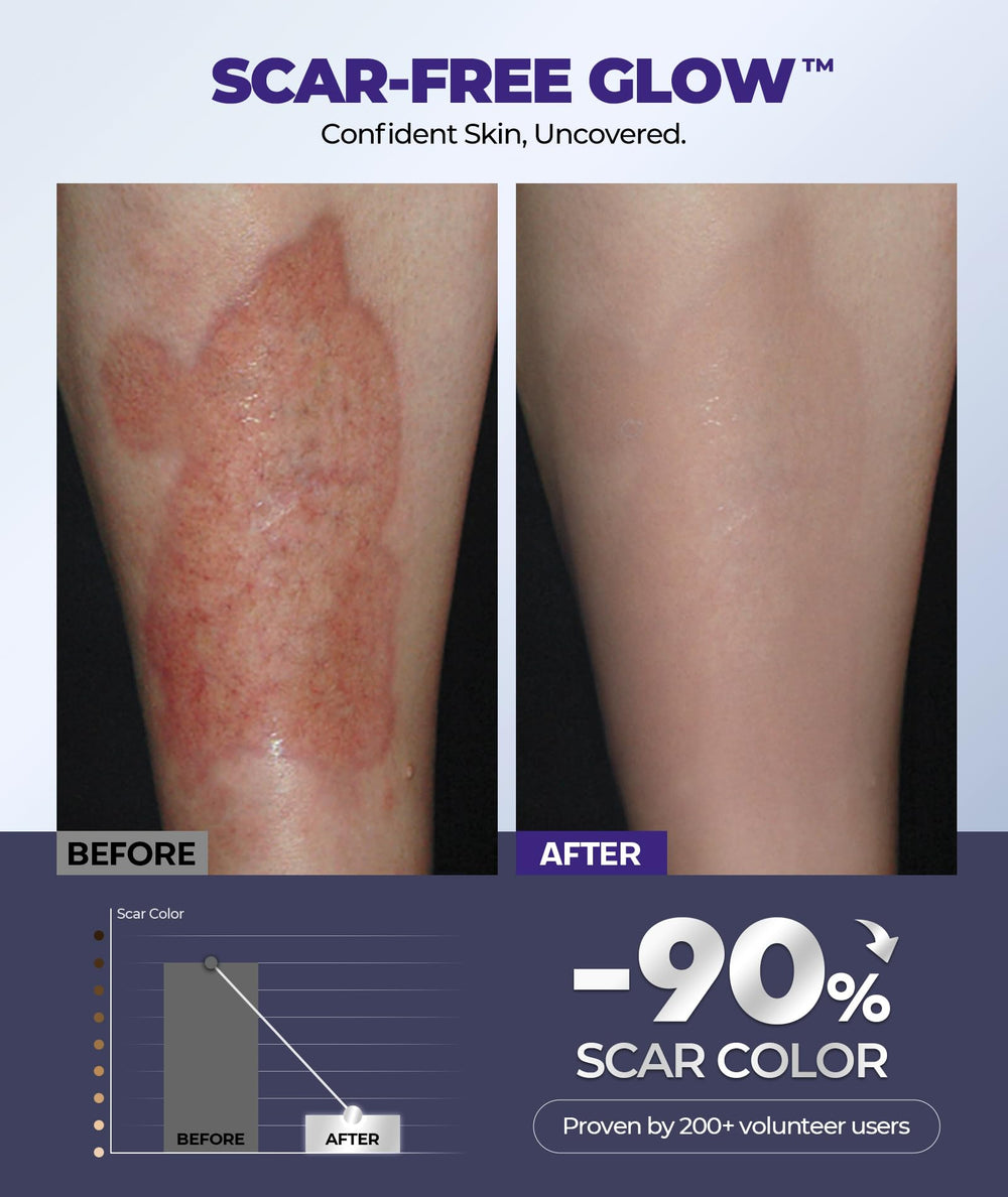 EASEWAVE scar cream helps dry skin with extended 72-hour comfort.