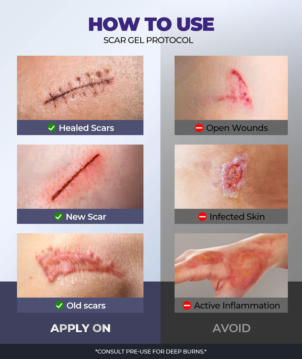 EASEWAVE scar cream tube spread demonstrates quick absorption.