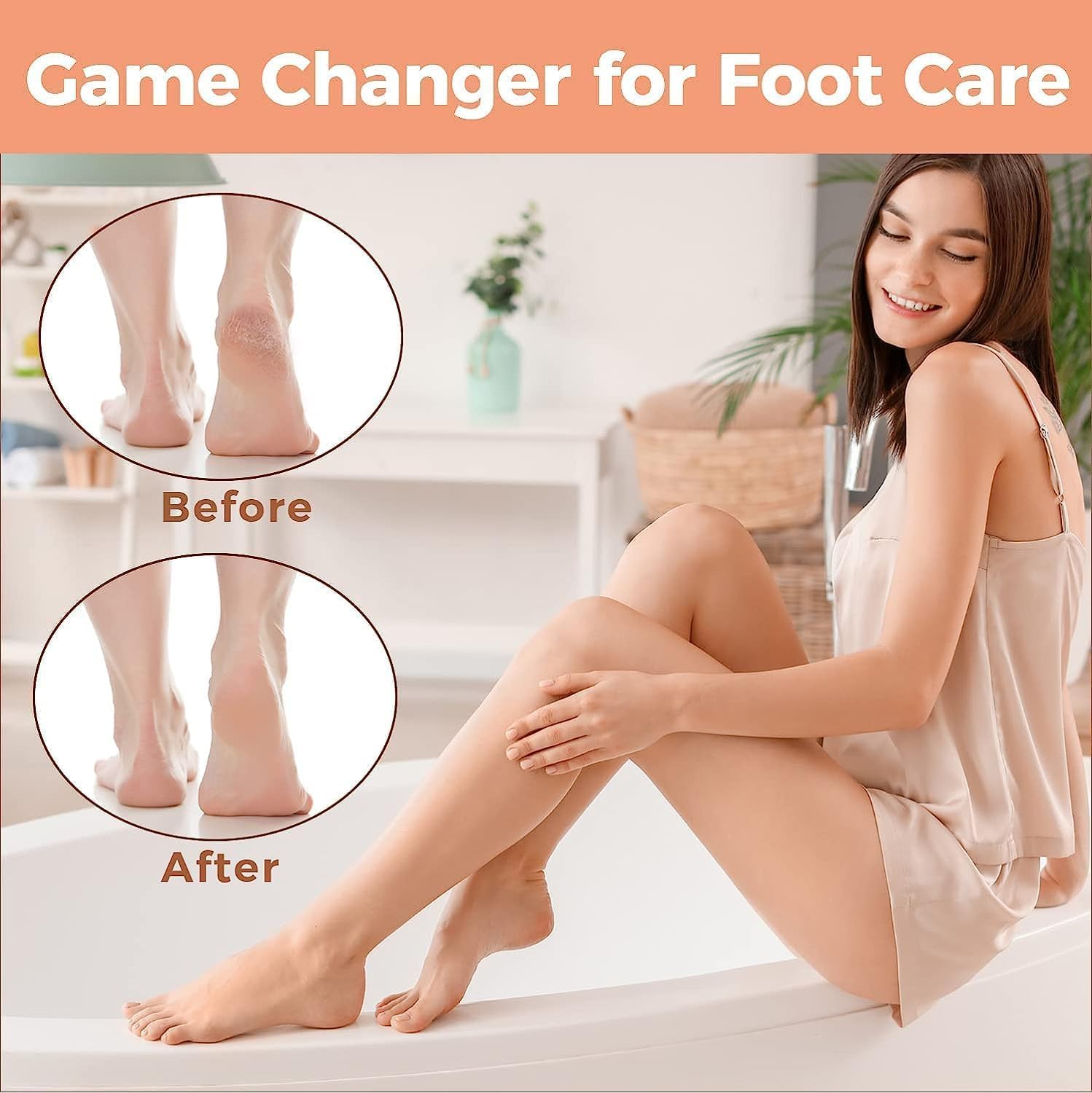 Easkep gift packaging signals a thoughtful foot care present.