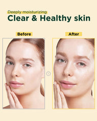 EASYDEW bottle highlights hyaluronic layers for deep hydration