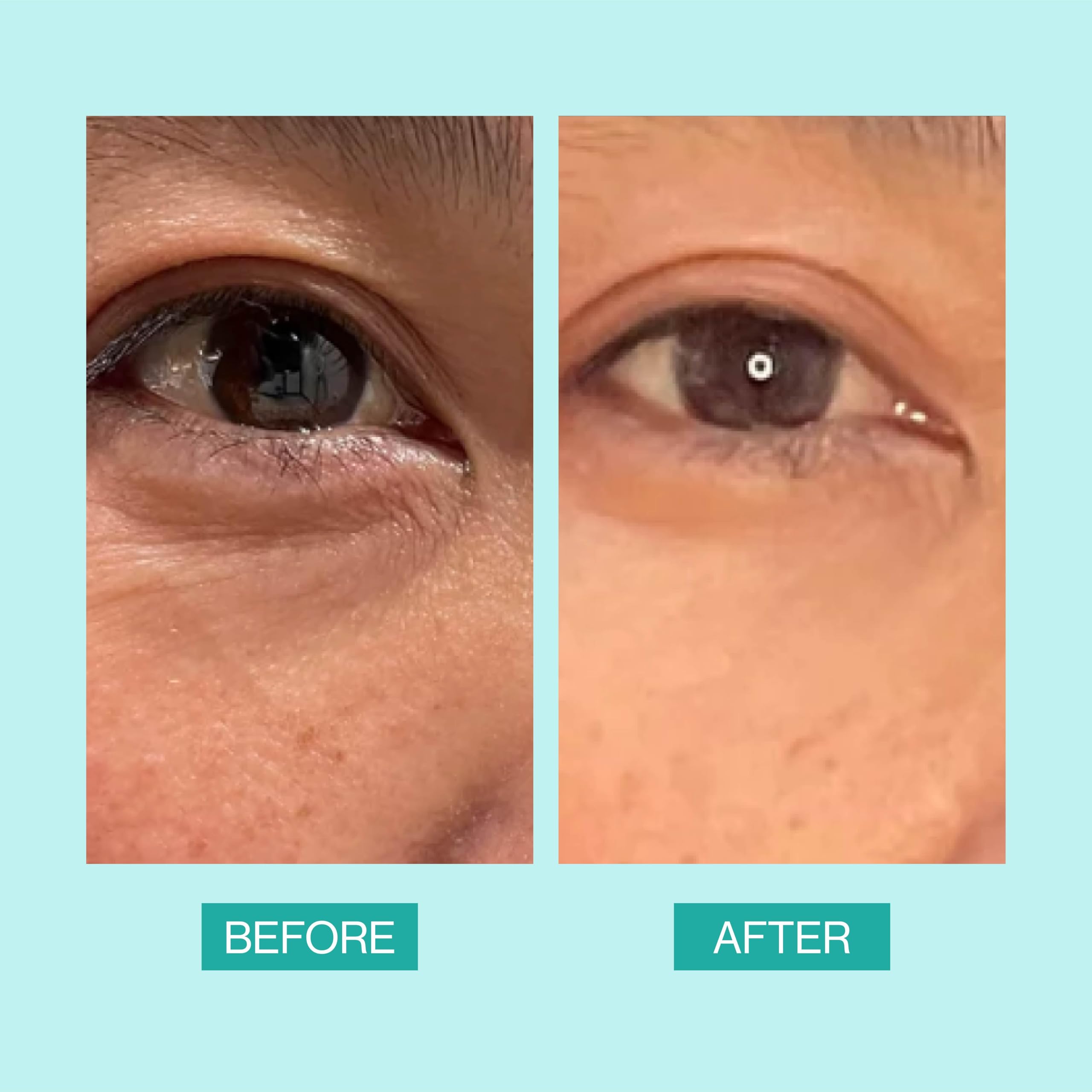 eb5 Daily Repair Eye Treatment skin texture closeup showing smoothing effect.