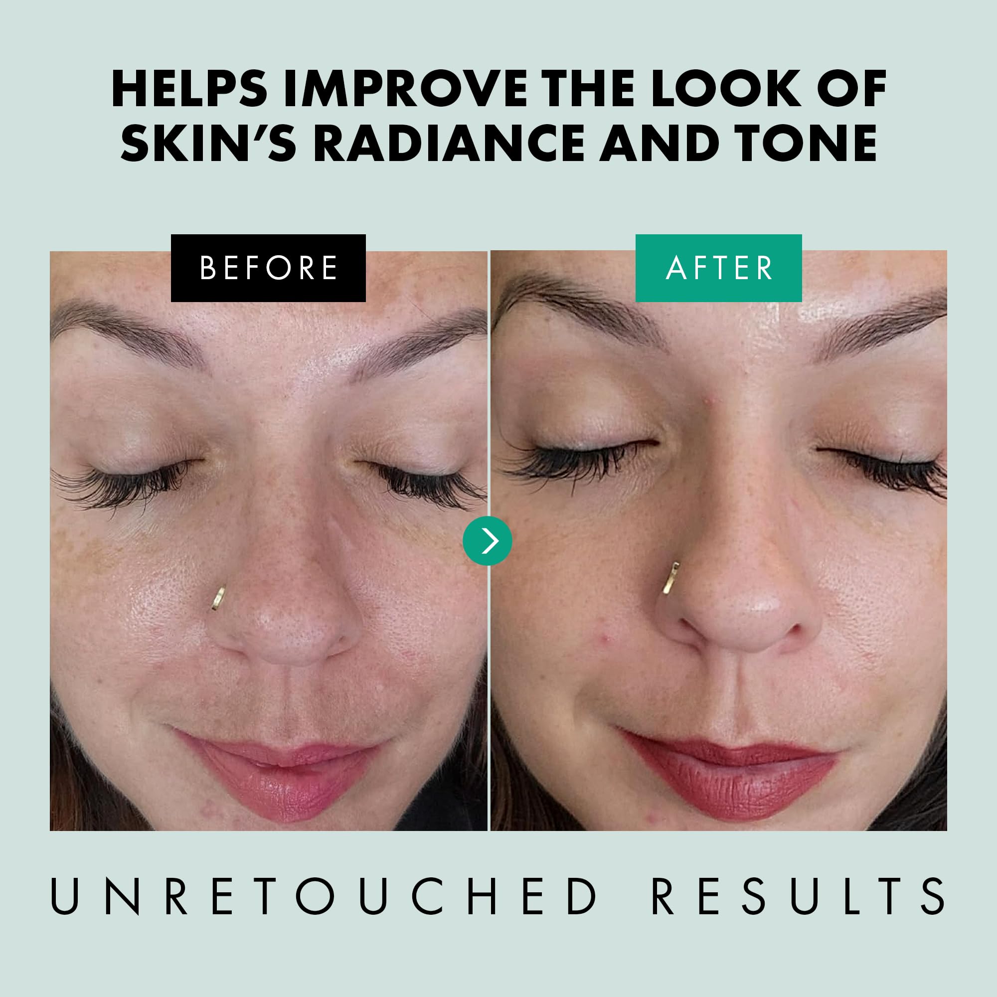 Eclat Skincare Clarifying Niacinamide Serum application on skin promoting refinement