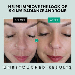 Eclat Skincare Clarifying Niacinamide Serum application on skin promoting refinement