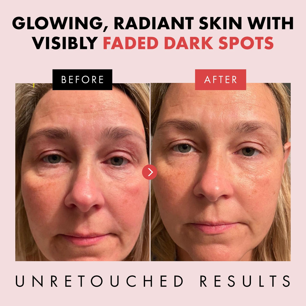 Eclat Skincare Renewing Retinol Serum application on skin demonstrates smooth absorption.