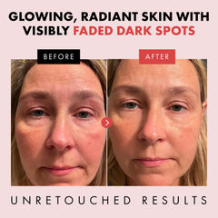 Eclat Skincare Renewing Retinol Serum application on skin demonstrates smooth absorption.