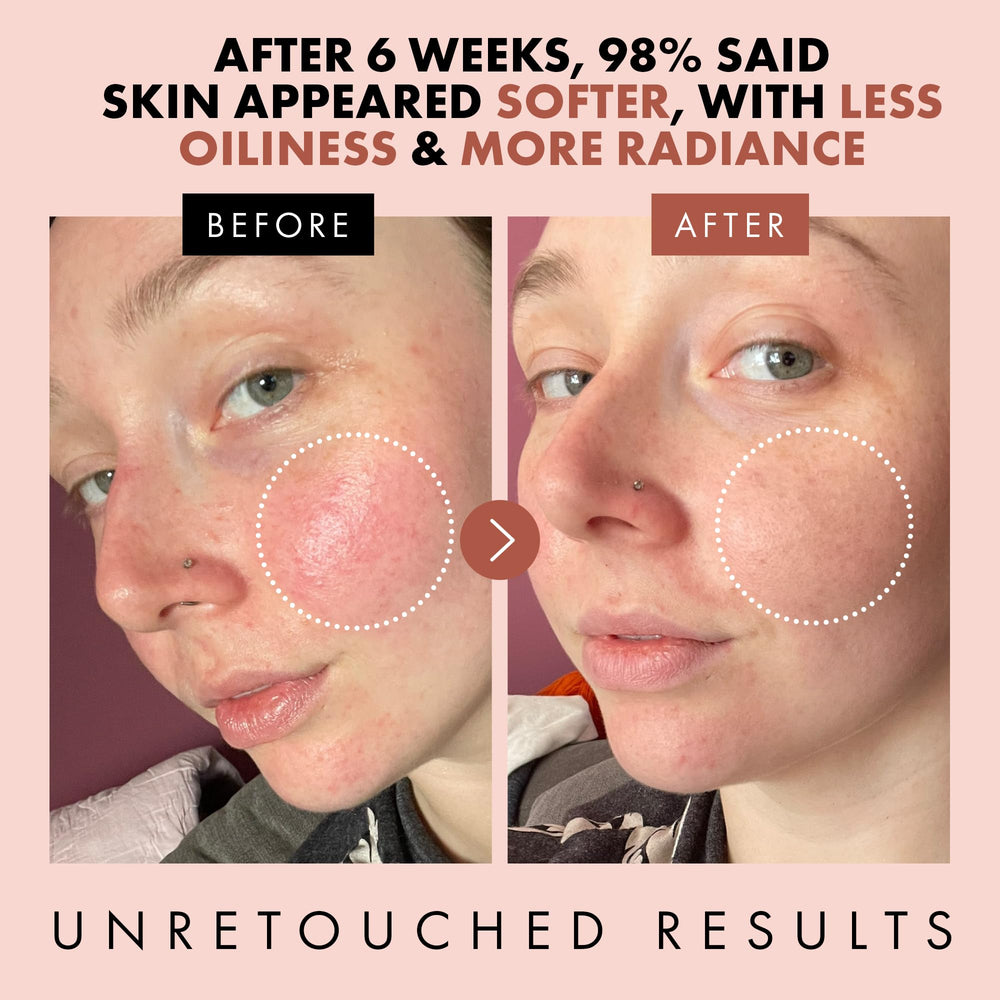 Rose detail highlight shows antioxidant-rich petals for a healthy glow.