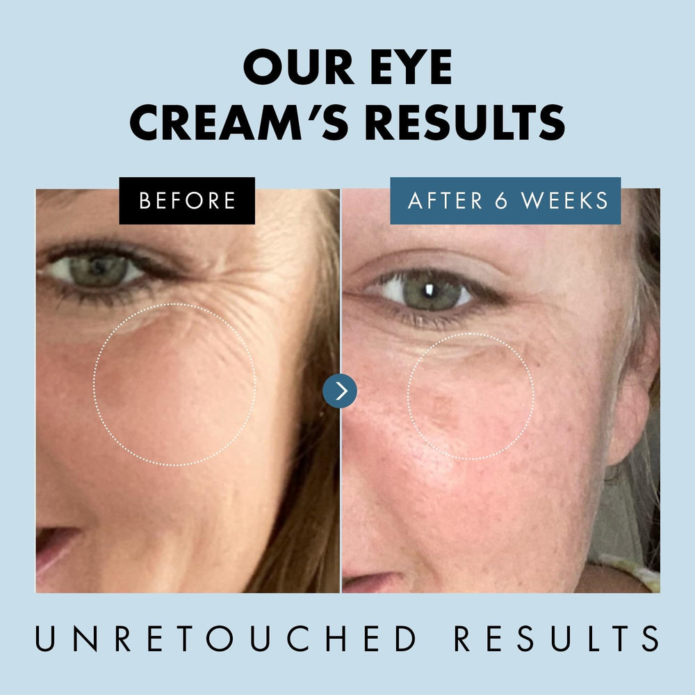 Eclat Skincare under eye cream helps smooth fine lines around the eyes.