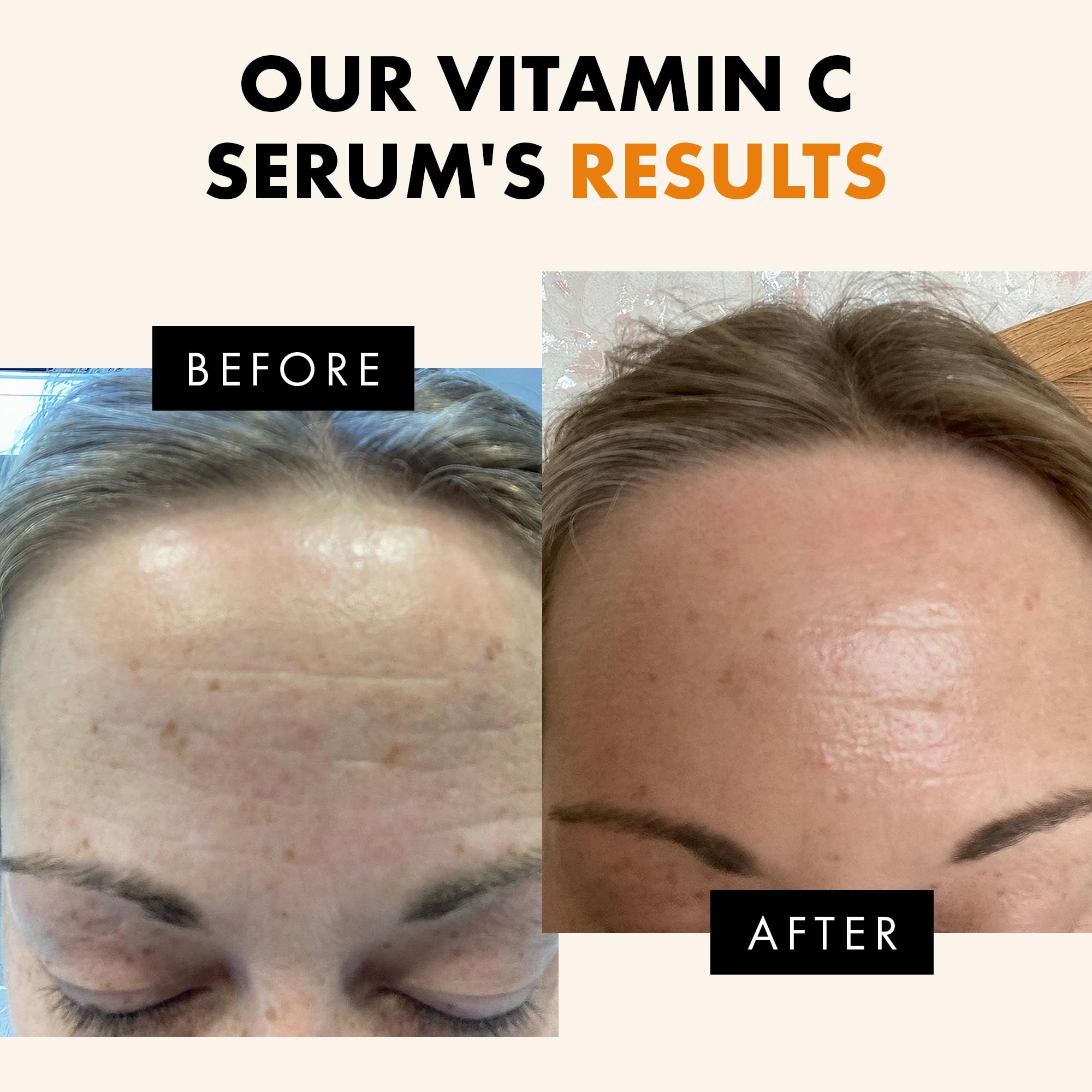 Eclat Skincare Vitamin C Serum with aloe vera soothing moisture