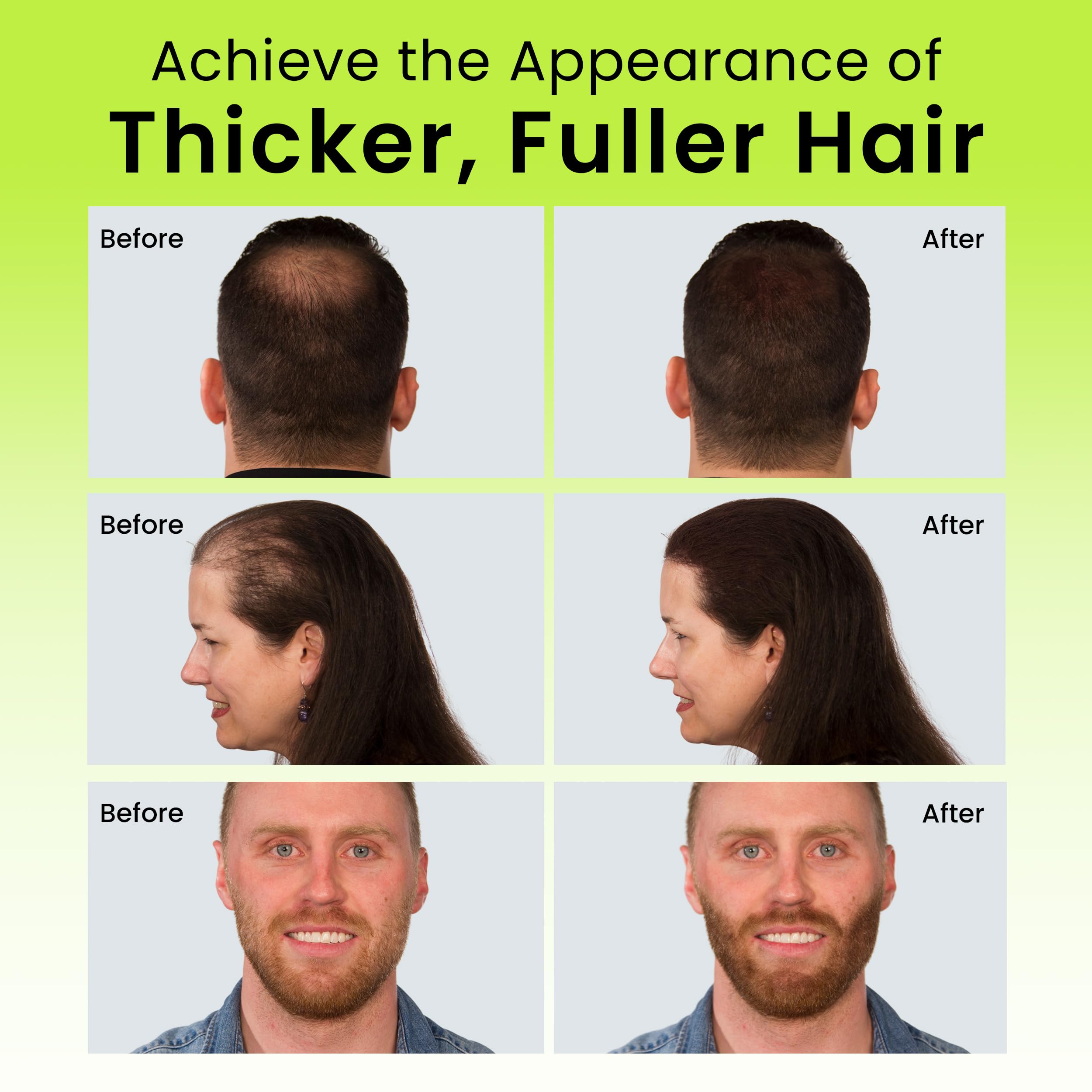 Eclipse Hair Fibers Dark Blonde crown coverage creates a fuller silhouette.