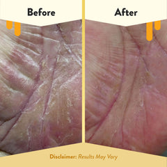 ECZEMA HONEY Brown Sugar Scrub face application demonstrating mild exfoliation for dry skin.