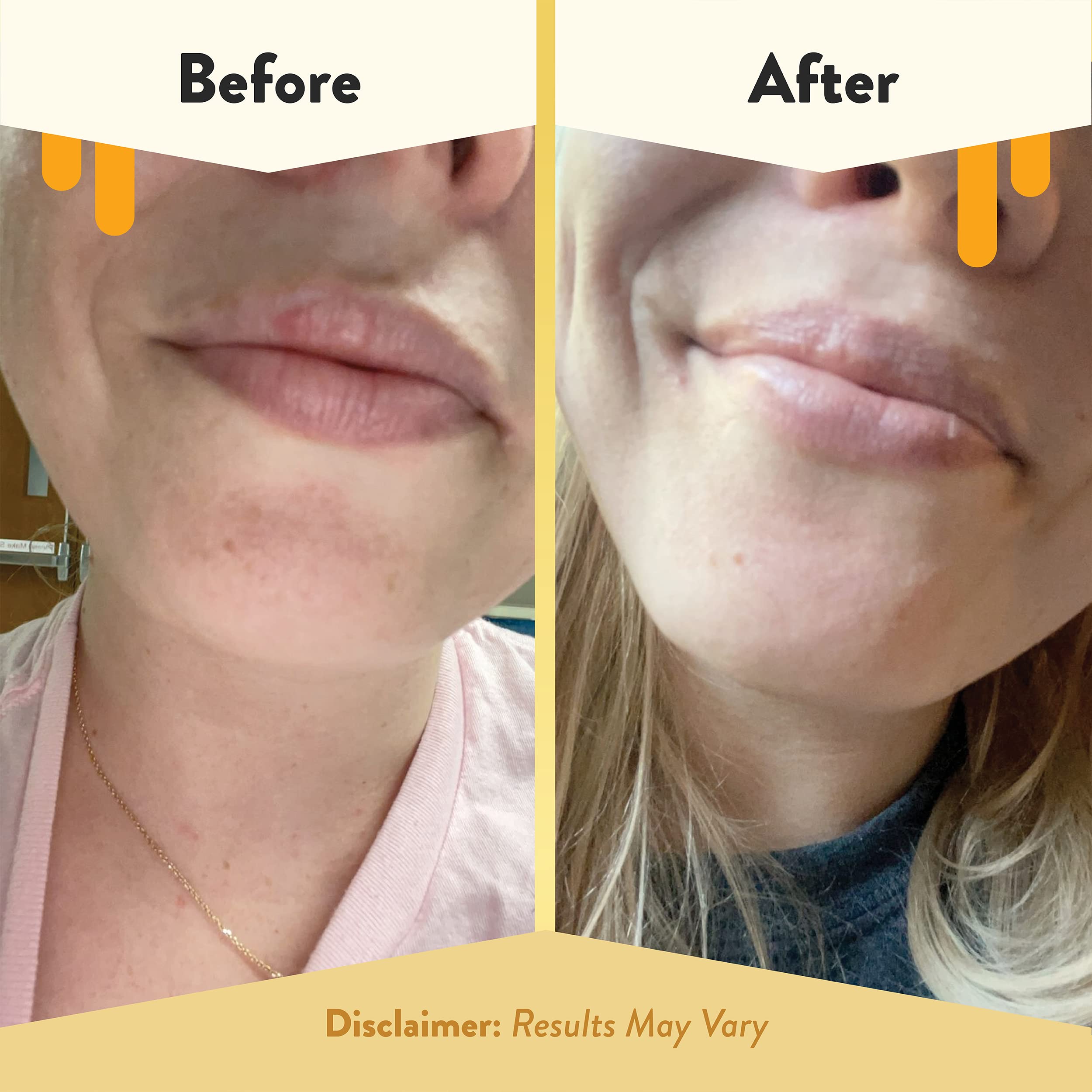 ECZEMA HONEY Colloidal Oatmeal Lip Soother eases dryness and irritation.