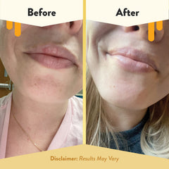 ECZEMA HONEY Colloidal Oatmeal Lip Soother eases dryness and irritation.