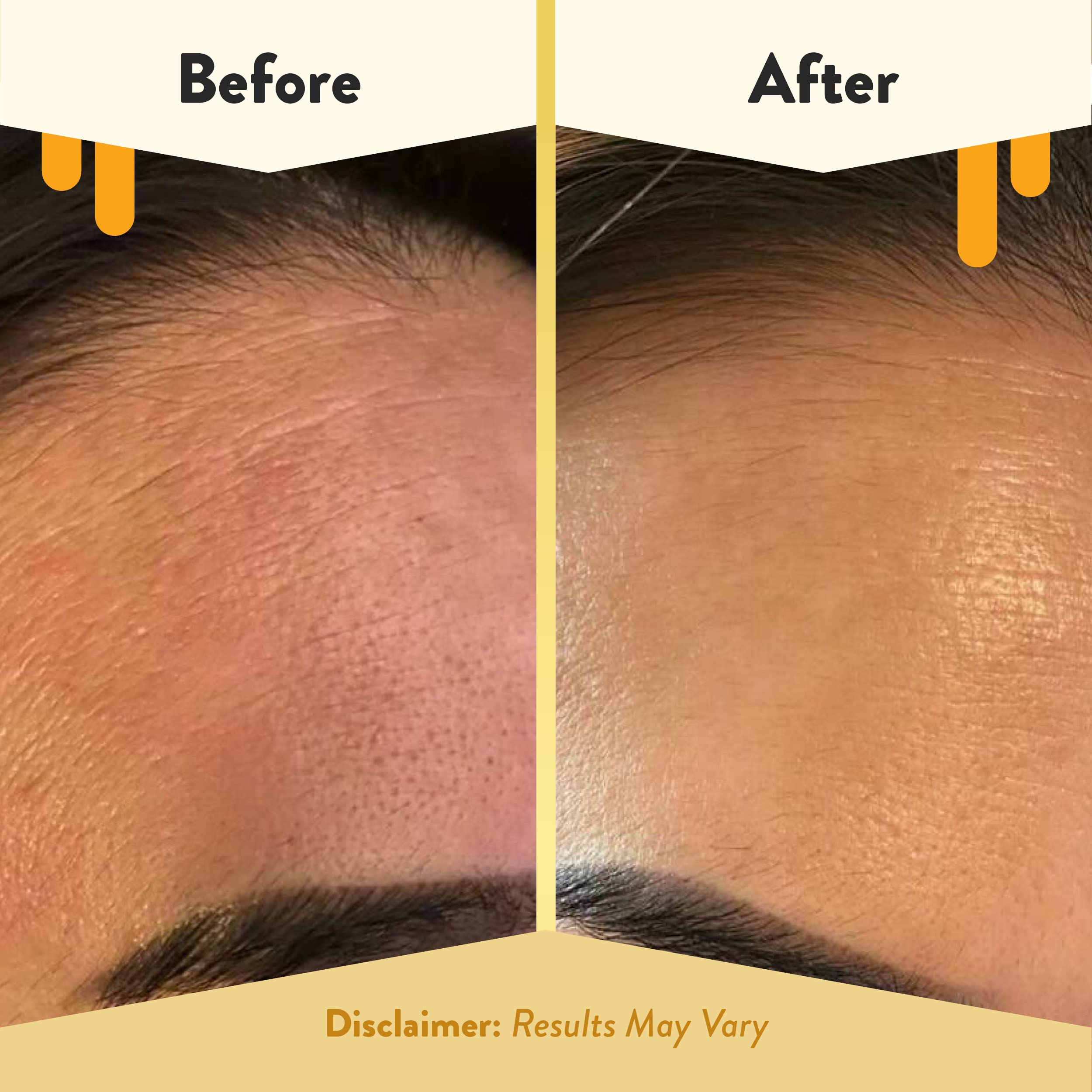 Creamy texture close up suitable for delicate facial skin during flare ups