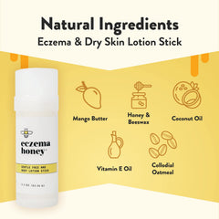 ECZEMA HONEY application on hand demonstrates easy, mess-free eczema moisture.