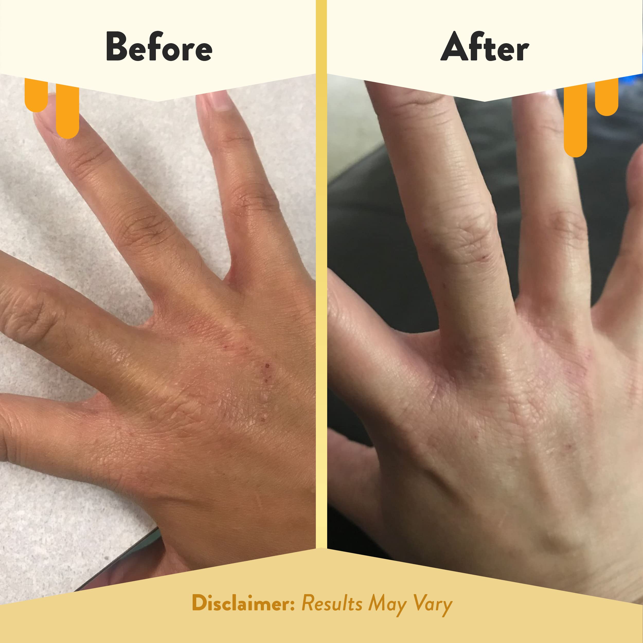 ECZEMA HONEY Premium Witch Hazel and Aloe Spray label highlights fragrance-free formula.