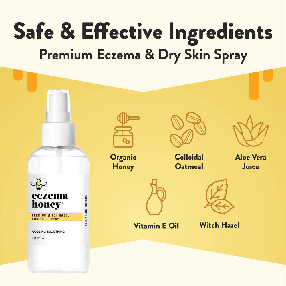 ECZEMA HONEY Premium Witch Hazel and Aloe Spray mist on face shows cooling hydration.