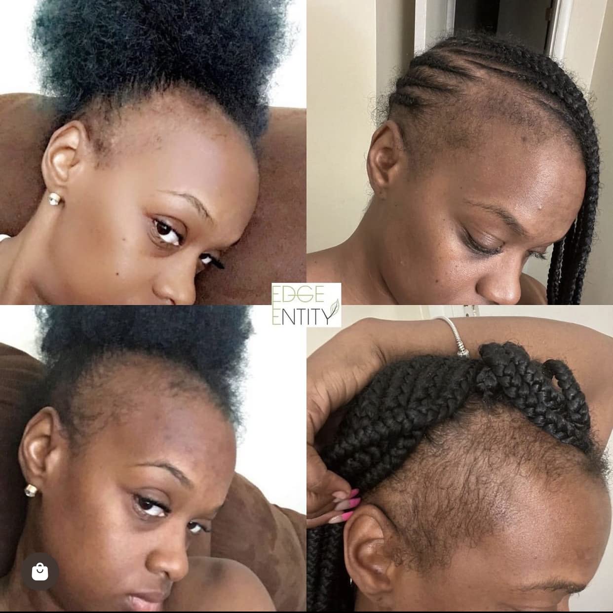 Edge Entity Daily routine-use image suggests simple integration into hair care