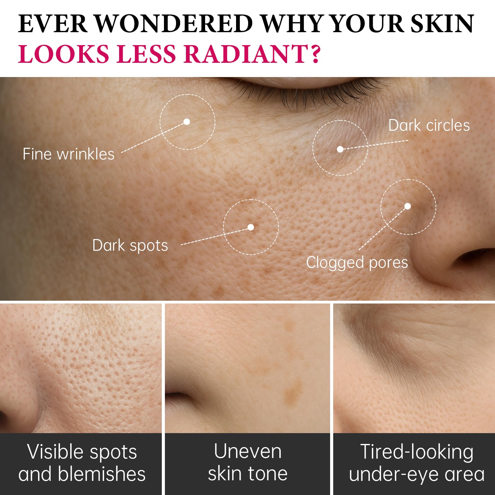 EELHOE label highlights key ingredients arbutin and TXA for pigmentation care.