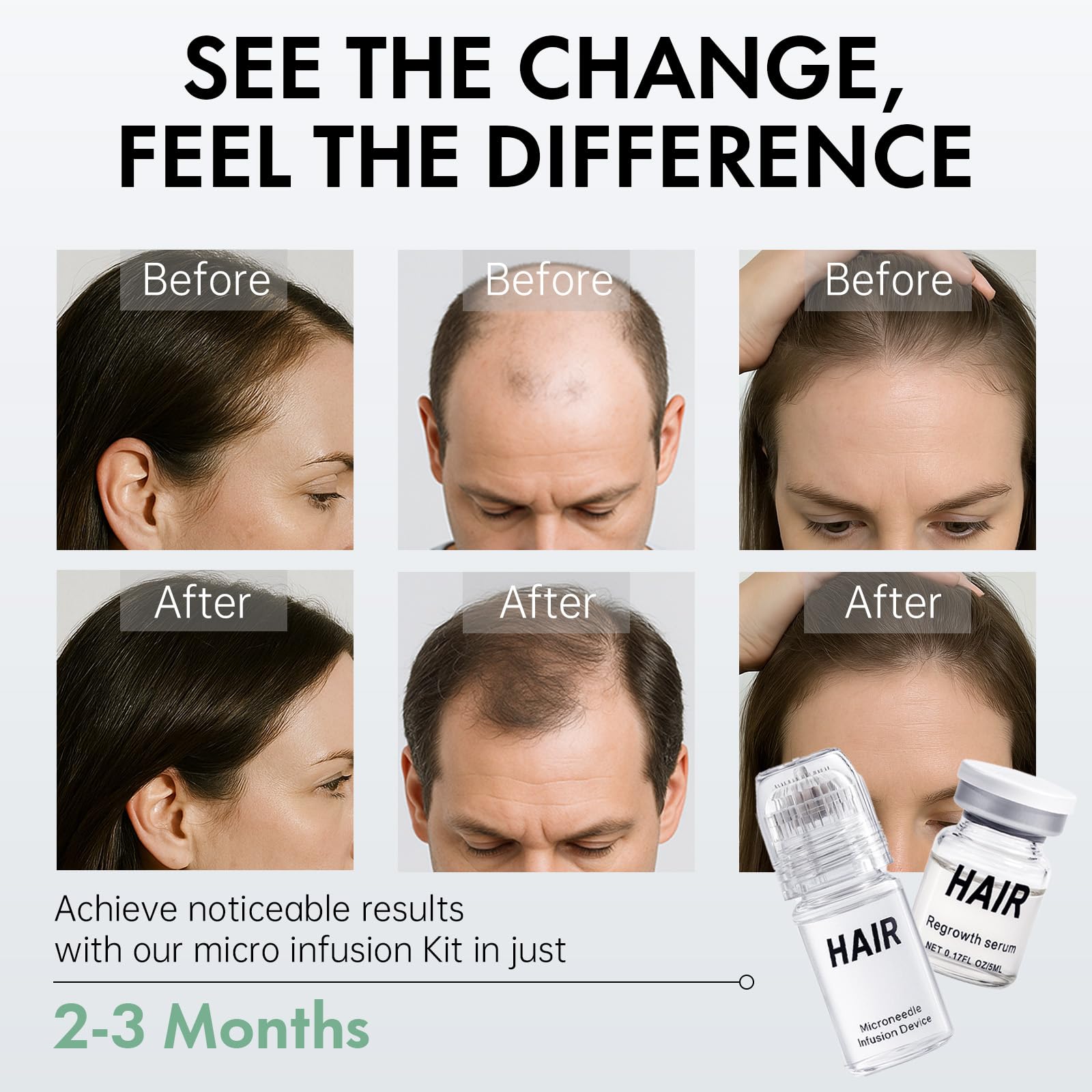 EELHOE serum bottle featuring Angelica for balanced scalp care.