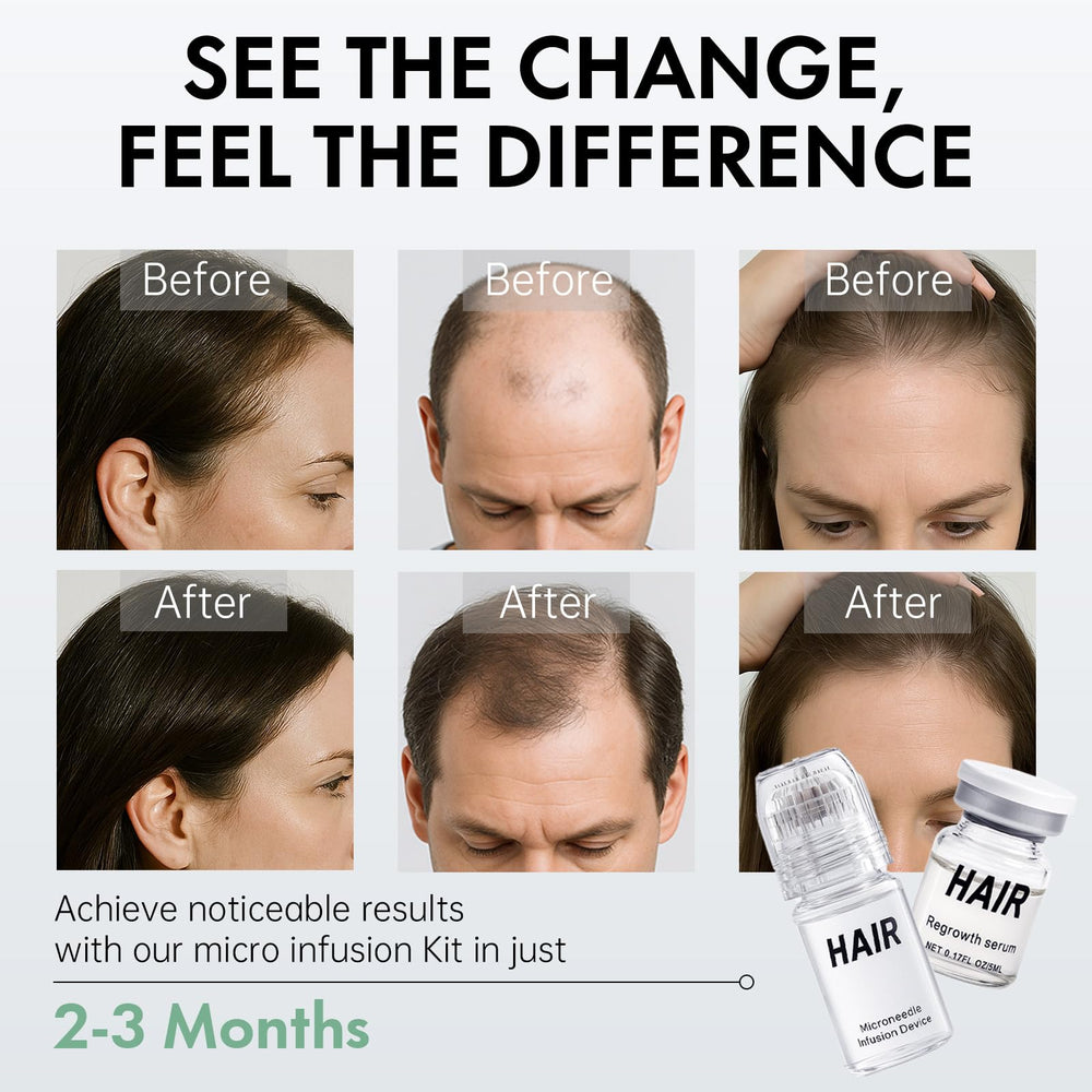 EELHOE serum bottle featuring Angelica for balanced scalp care.