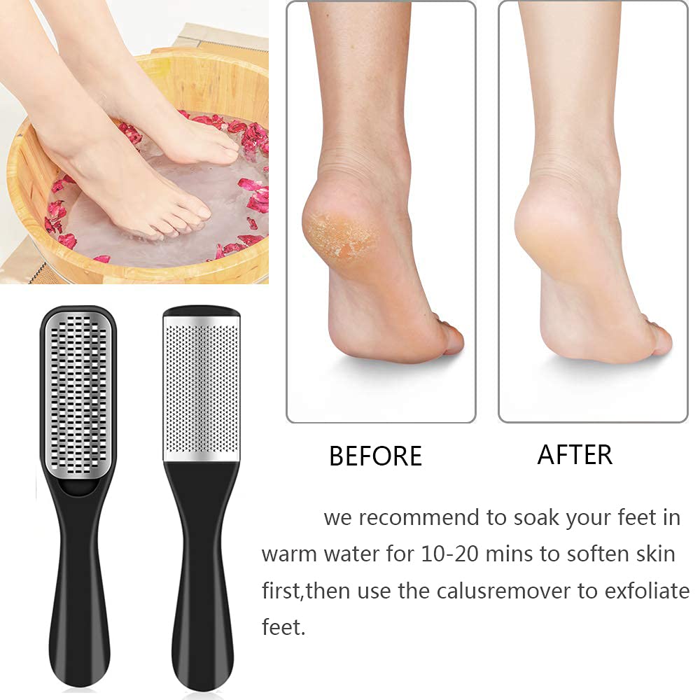 EKOCSIO 36-in-1 pedicure kit callus remover for gentle exfoliation