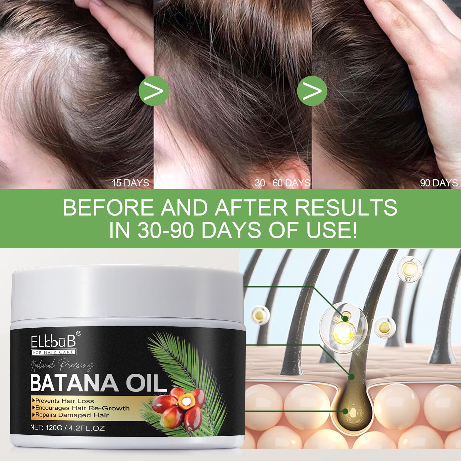 ELBBUB Batana Oil massage on scalp – supports hydration.