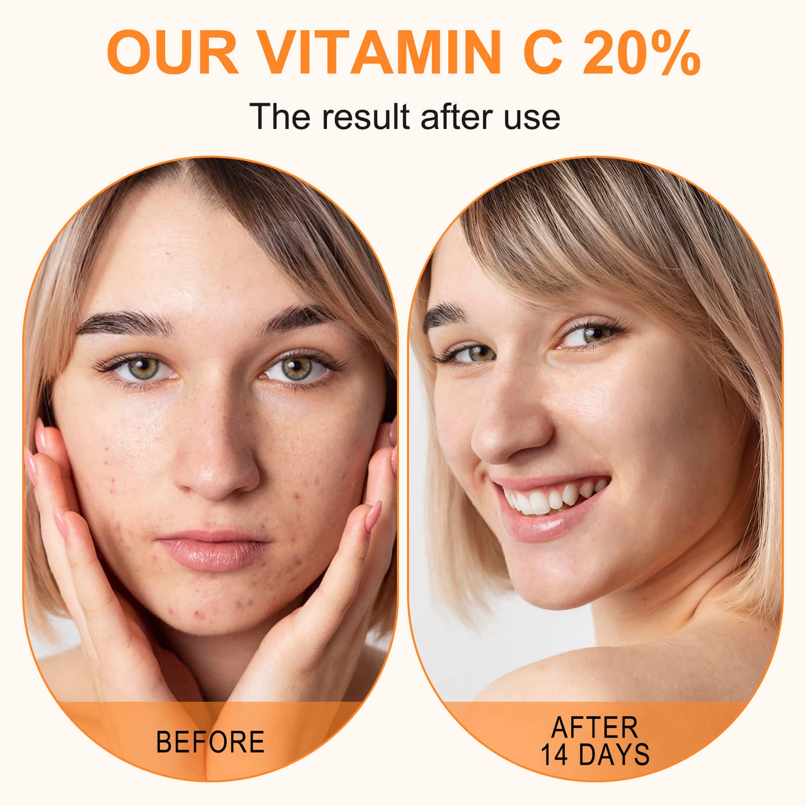 ELBBUB retinol active complex image suggests anti-aging support