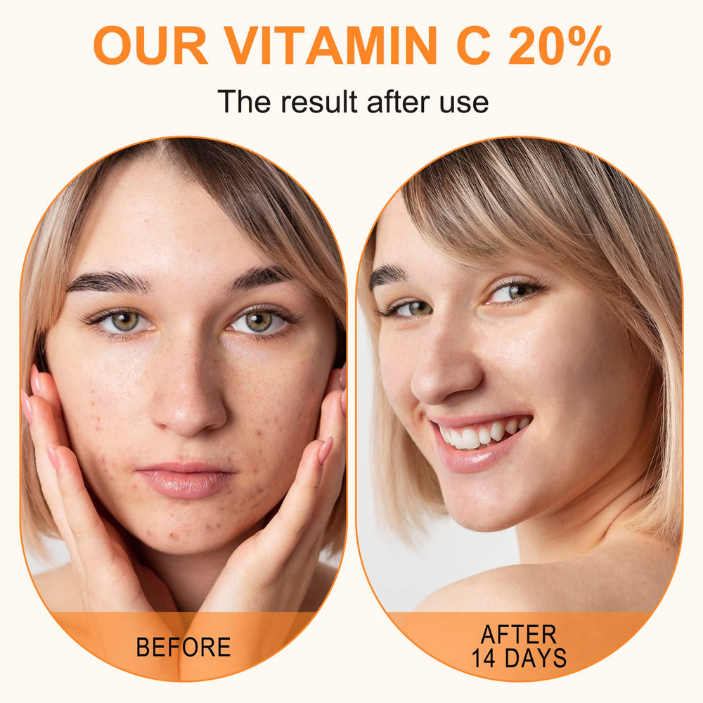 ELBBUB retinol active complex image suggests anti-aging support