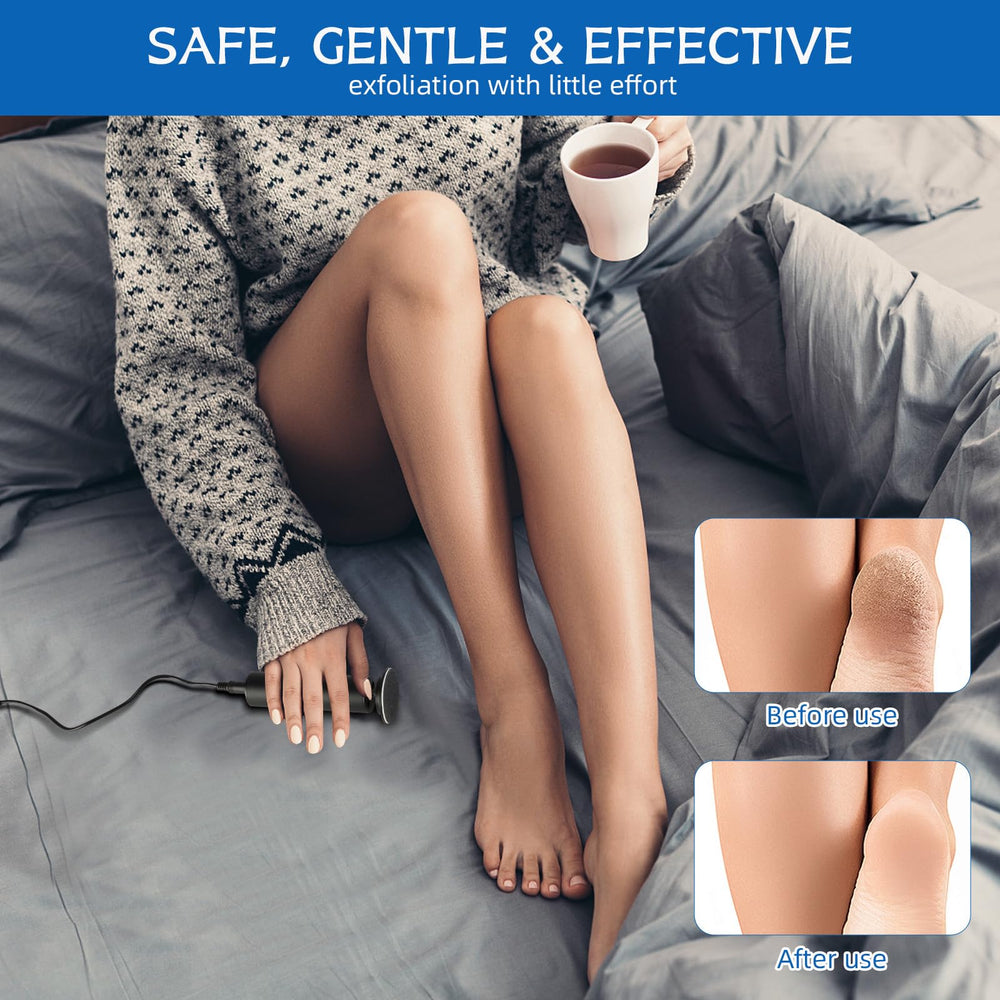 Electric Foot Callus Remover compact design fits neatly on a vanity or travel kit.