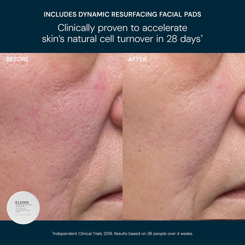 Elemis Dynamic Resurfacing Facial Wash bottle, cleanses while refining texture for smoother skin.