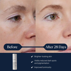 Elemis Dynamic Resurfacing Serum outer packaging highlighting brightening formula