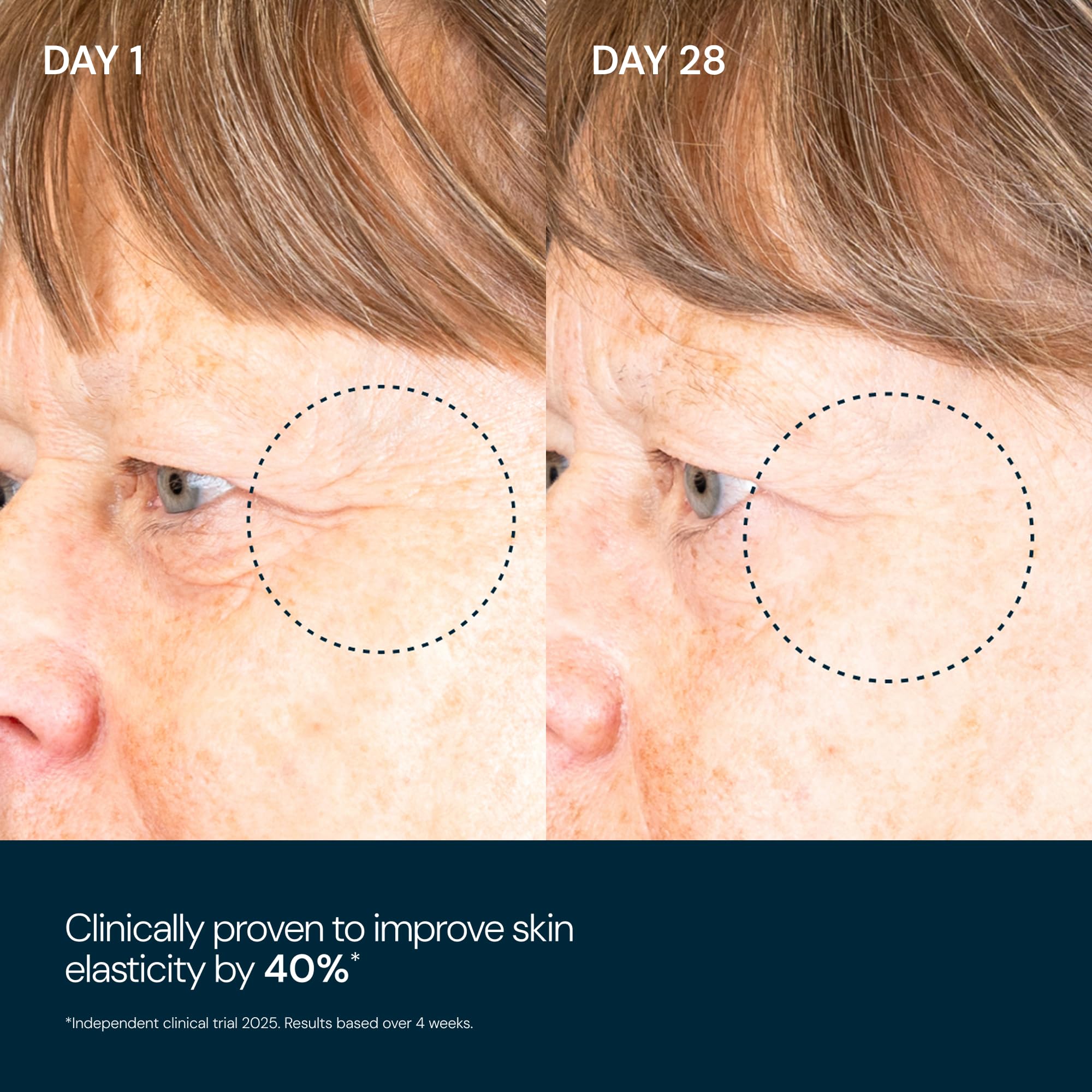 Skin close-up after applying Elemis Pro-Collagen Overnight Matrix reveals glow and hydration