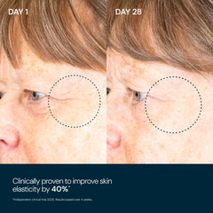 Skin close-up after applying Elemis Pro-Collagen Overnight Matrix reveals glow and hydration