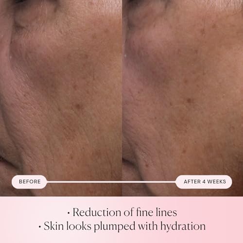 Elemis Pro-Collagen Rose Micro Serum bottle side view shows sleek design for daily use.
