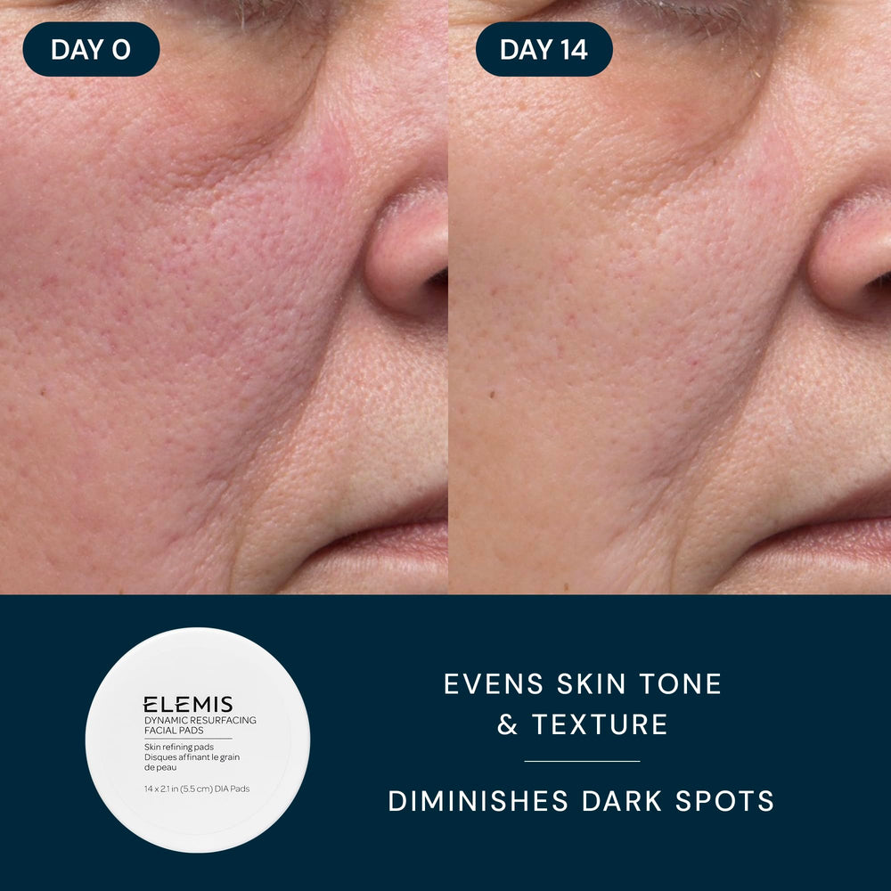 Elemis Resurfacing Pads being used on skin surface