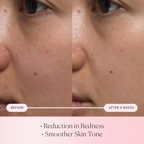Elemis Rose Micro Droplets closeup reveals tiny droplets delivering surface hydration.