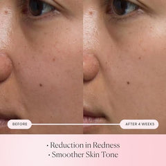 Elemis Rose Micro Droplets closeup reveals tiny droplets delivering surface hydration.