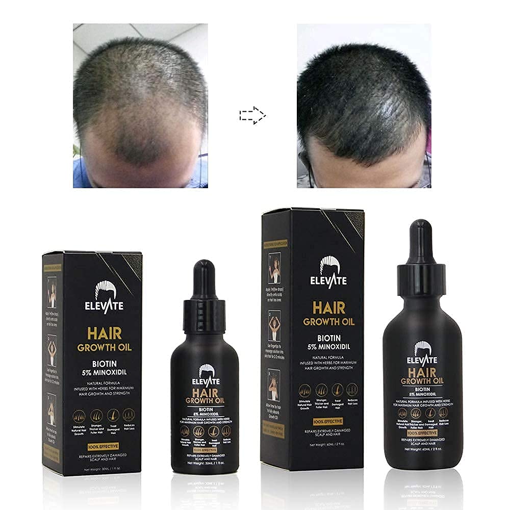 Elevate hair growth oil on strands hints at nourished roots and smoother ends.