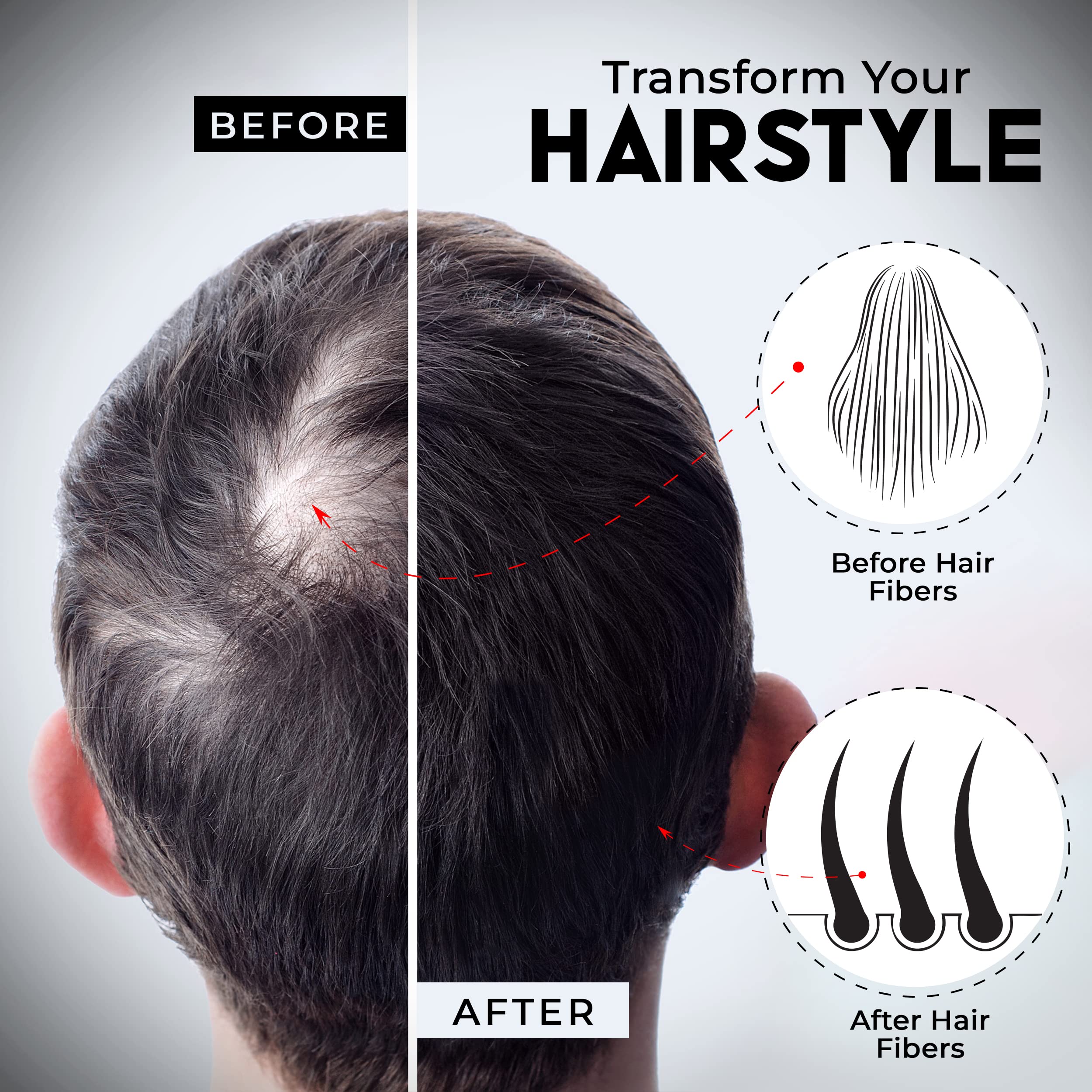 Elevate Hair Perfecting Kit crown thinning area blending for natural density
