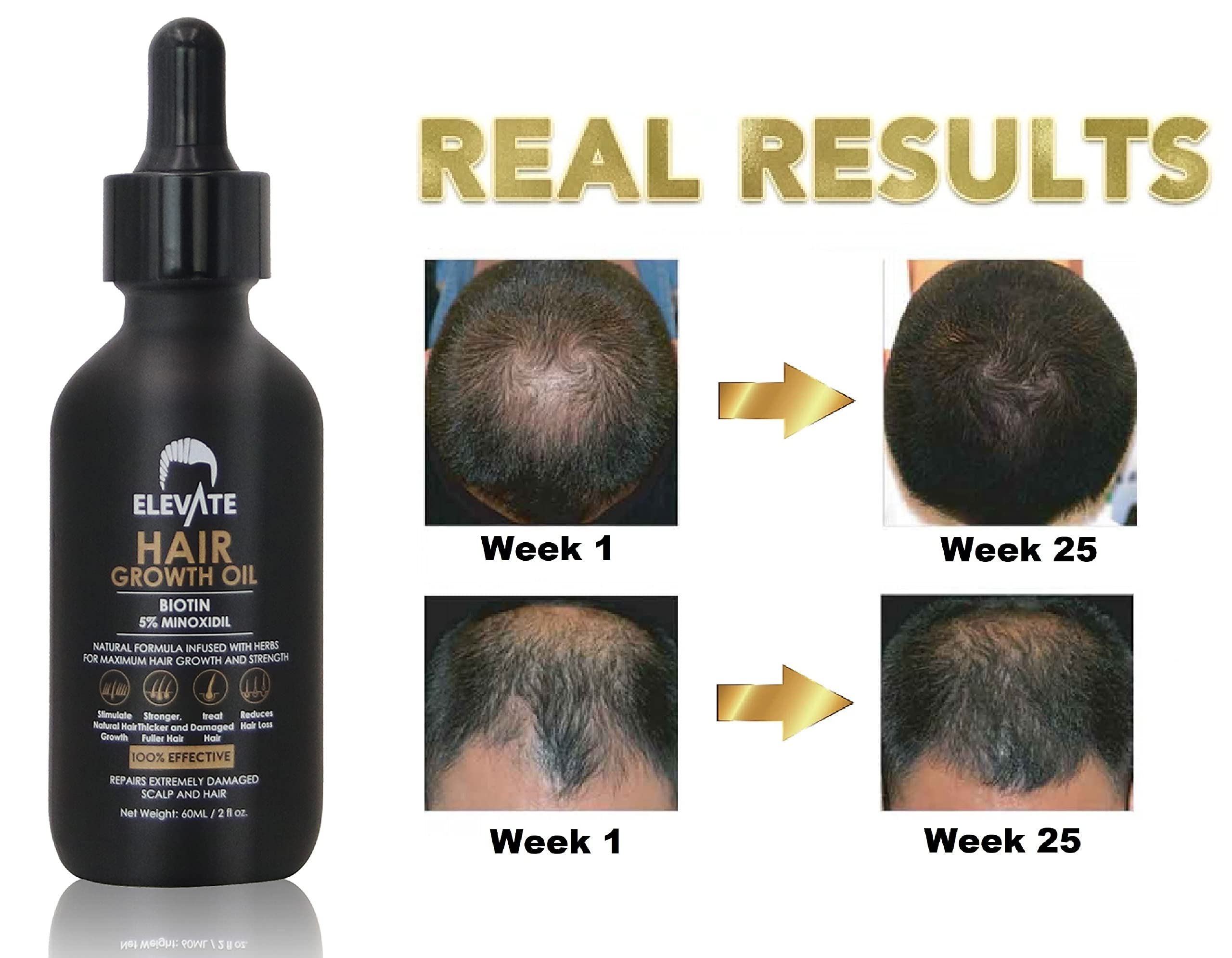 Elevate Hair Regrowth bottle cap close-up emphasizes secure cap