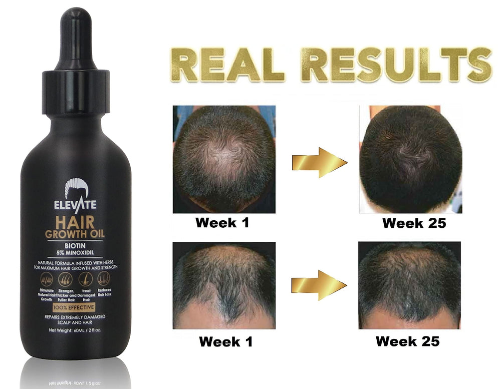 Elevate Hair Regrowth bottle cap close-up emphasizes secure cap