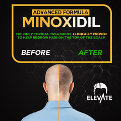 Elevate minoxidil spray dispenses 1ml for controlled daily use.