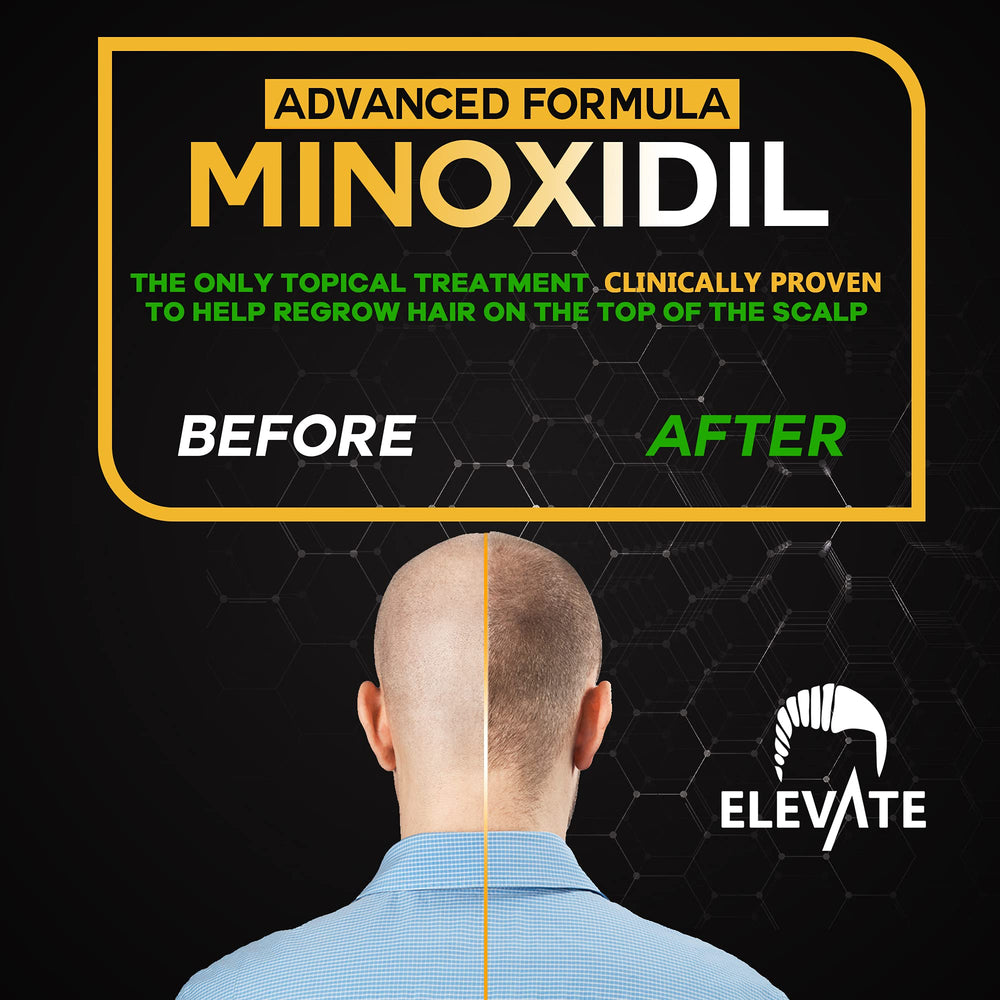 Elevate non-greasy, fast-absorbing formula on the scalp during use.