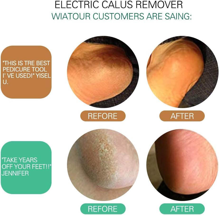 ELEVEN EVER portable and lightweight device ideal for travel foot care