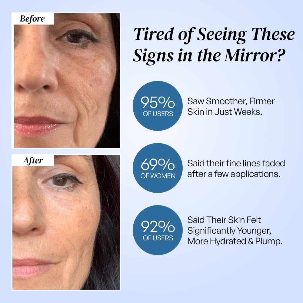 Eliré skin-firming close-up illustrates taut, smoother-looking complexion.