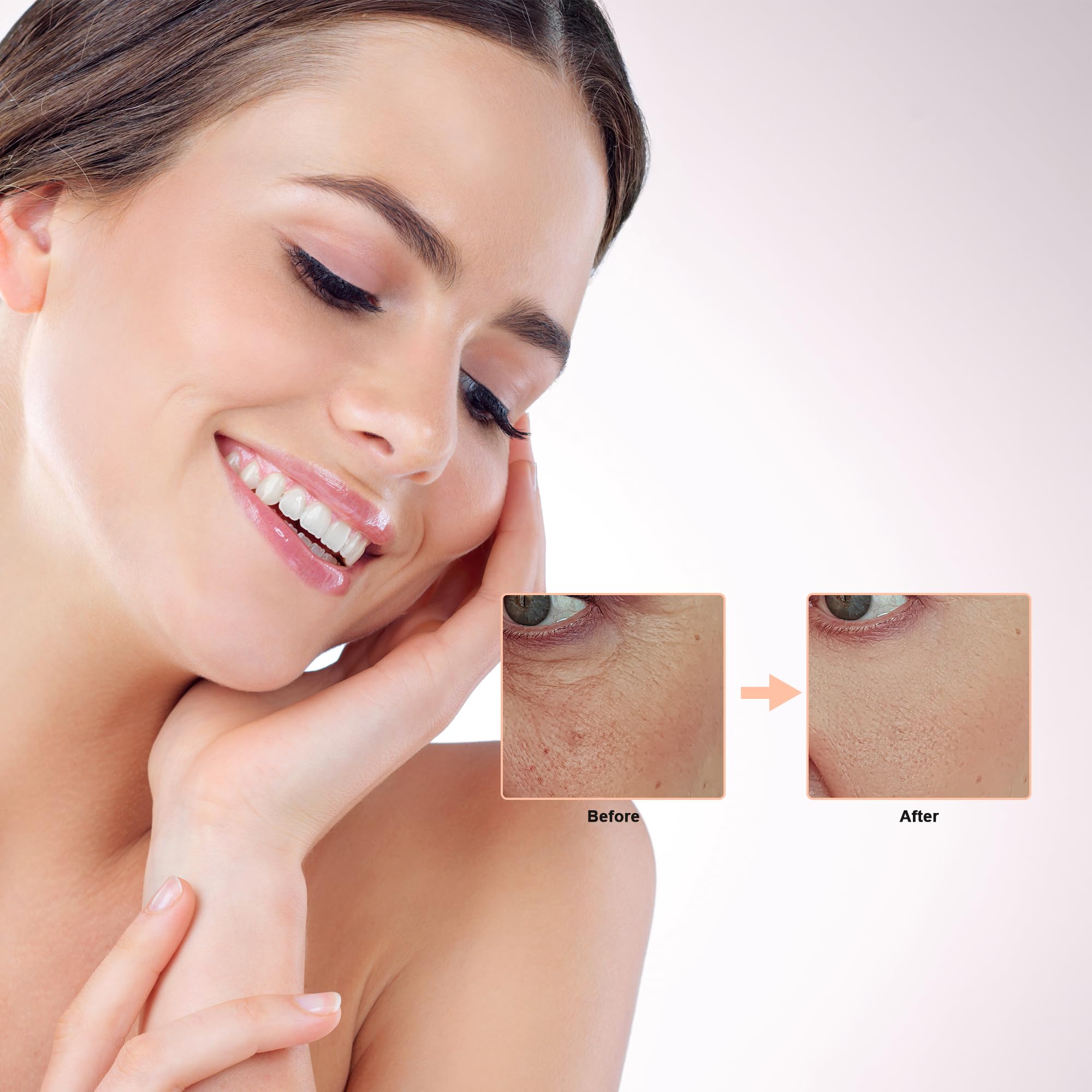 Elitzia CO₂ Facial Kit serum locks in nutrients after treatment.