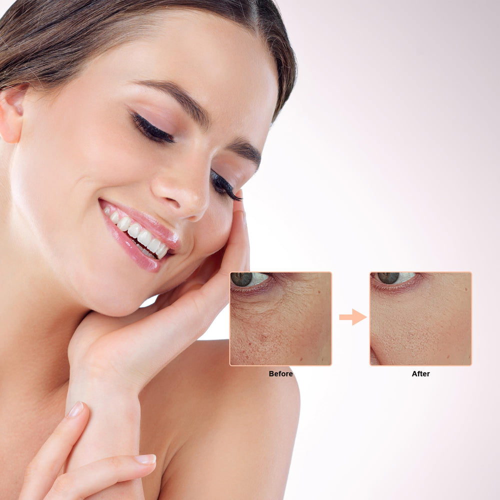 Elitzia CO₂ Facial Kit serum locks in nutrients after treatment.